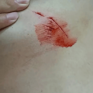 布尔戈斯vs拉斯彭马斯_罕见！大连钓友钓到一条20斤大鲅鱼布尔戈斯vs拉斯彭马斯，反被鲅鱼利齿咬伤胸部