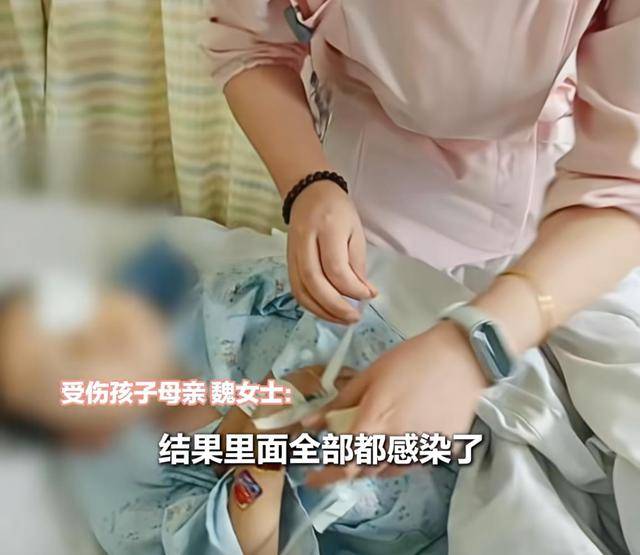 马耳他 vs 荷兰
_江西一5岁男孩在幼儿园被戳伤致左眼失明马耳他 vs 荷兰
,家长称老师用猪油涂抹试图消肿